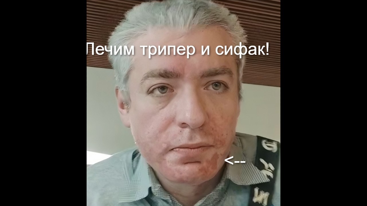 Герман — оу