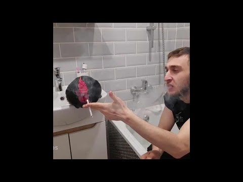 Аслан — Дауны да?